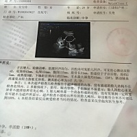 有知道男女的吗？