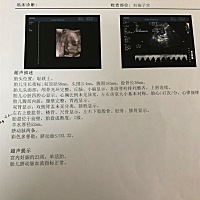 请问有宝妈会看男女吗