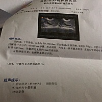 请问这样是不是很不好，好担心，医生开了保胎药，其他症状都没