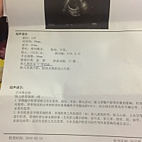 看其他宝妈发个检查图就知道男女了，那我也发一个图，有专业人士给我看看呗！