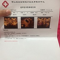 正常吗，帮忙看看