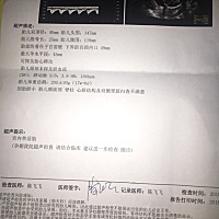 娱乐一下大家帮忙看下是男是女