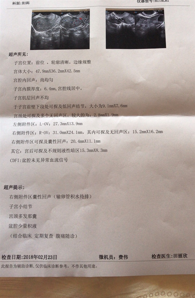 这是2月23彩超结果