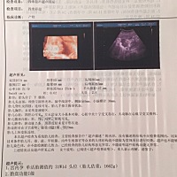 各位，帮忙看看是女宝还是男宝