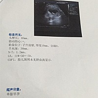 请问大家能看出这是男孩女孩啊？