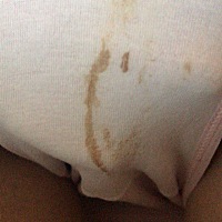 亲们怀孕50天，突然有这个现象，这俩天没有了，现在吃着黄体酮，请问有类似情况的吗？呜呜。最近腰还疼...