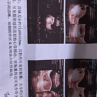 请问各位准妈妈们这是怀孕多少天啊，大夫说有50天，但是我上个月14号来的例假，时间上推算不可能啊