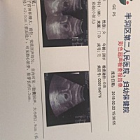 请问谁能看出我这个是多少天呀！？