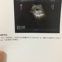 两个月 可以看出男孩女孩嘛 哪位有经验的宝妈 帮忙看下