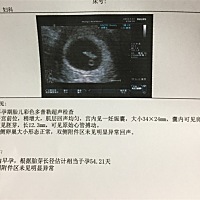 开心，今天查有胎心咯，宝宝发育得很好😊