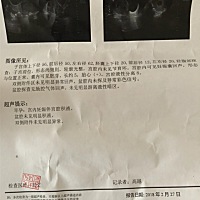 有啥问题吗。第一胎。没有经验。49天了