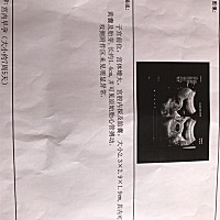 怀孕快8周了，身体一如既往的没有什么变化，也不想别人那样孕吐，昨天肚子有出血带走血块，去了医院做了...