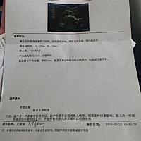 能看出来男孩女孩吗