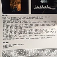 做的四维彩超，可为什么图片不是很清楚呢，脸也看不清！大家能帮忙看下吗！嘴巴那个地方是啥啊