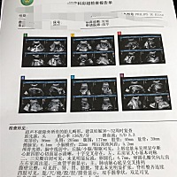 各位宝妈谁能看出是男是女，谢谢