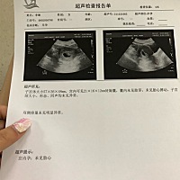 怀孕7周了为什么B超没有胎芽胎心？