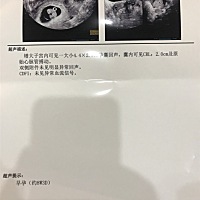 亲们，能看出是男是女吗