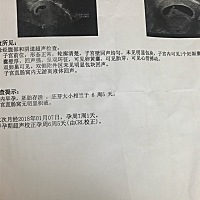 六周➕6今天有胎心胎芽啦啦啦 宝宝加油