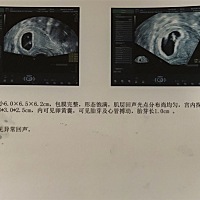 请问大家这是个男孩女孩?谢谢