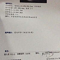 各位帮忙看一下是男孩还是女孩，男孩女孩都无所谓。就是比较好奇。有人说看b超可以看出来男孩女孩。