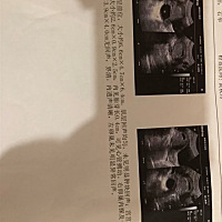 有经验的宝妈看看男孩女孩，很好奇😁😁