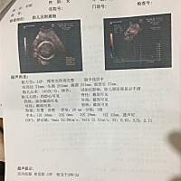 啦啦啦啦啦😝😝