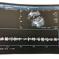 小花生不知道是男宝宝还是女宝宝，大家猜一猜。