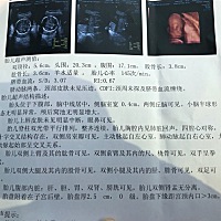 猜猜男宝女宝？