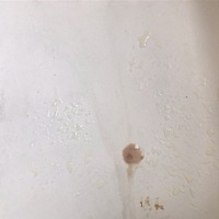 今天上厕所，白带颜色有点深，里面有点血丝，这是什么情况啊