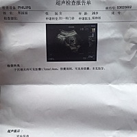 停经40天，刚去医院照的B超，医生说目前很正常，大家是这种情况吗？