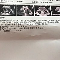 一切健康就好，还有一个月左右就与你见面了，