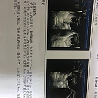 九周 4b超单，男孩还是女孩