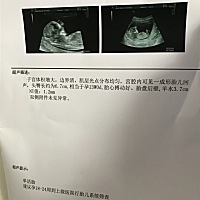 大家能否帮我看下是男孩还是女孩