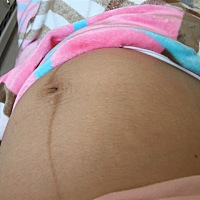 怀孕二十九周体重长了二十斤！ 肚子长了一肚子汗毛！