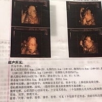 男孩还是女孩？