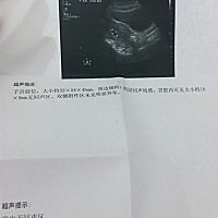 为什么没有回声 还见褐色的红，孕酮需要一星期才出结果 很烦！有知道的朋友吗