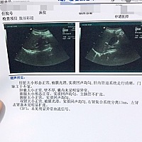 怀孕🤰23周 ，今天去医院检查！结果说肾积水.关键还有一些检查结果要三天拿！今天的这个结果也没挂号...