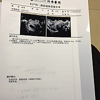 今天刚做的B超，都来娱乐一下，看看男女。