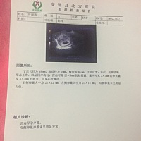 怀孕8周第一次照B超，有经验的宝妈帮我看看，