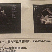 贵圈高人多，帮忙看看是男孩儿还是女孩儿，男女都无所谓，就是看贵圈引起了好奇心，谢谢大家