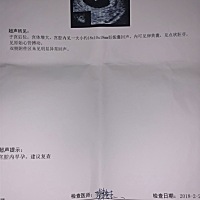 各位宝妈们 有没有看懂我这个是男宝还是女宝 40的单子 二胎很想要个男宝