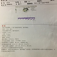 孕妈妈们帮我看下，现在胎儿大概是好多斤左右？？比超测量在正常范围之内吗？