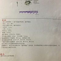 亲们帮我看下儿还是女，胎儿的大小大概有好多斤了？