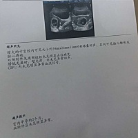 宝妈们，看看我这二胎的B超结果，可以看出男女宝宝吗？