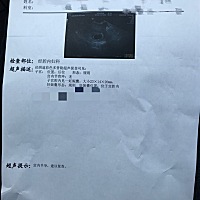 宝妈们，第一张是40天左右的B超单，第二张是两个月的B超单，大家能看出是男宝宝还是女宝宝吗？谢谢。