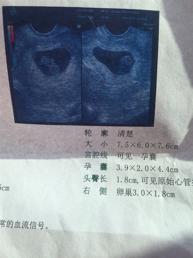 8周6，有经验的姐妹们，看的出男女么