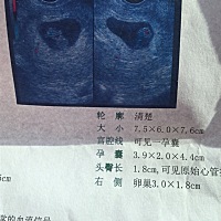 8周6，有经验的姐妹们，看的出男女么