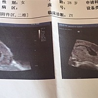 亲们，这是我57天的b超，能看出来男宝还是女宝嘛？