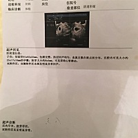 帮忙看看男女呗！