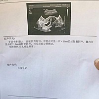 六周拍的，谁能看看男孩女孩，第二个月里一直想睡觉，什么油腻也吃不了，天天吃拉面😂😂😂